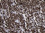 SMC1A Antibody in Immunohistochemistry (Paraffin) (IHC (P))