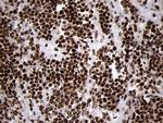 SMC1A Antibody in Immunohistochemistry (Paraffin) (IHC (P))