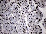 SMC1A Antibody in Immunohistochemistry (Paraffin) (IHC (P))