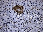 SMC1A Antibody in Immunohistochemistry (Paraffin) (IHC (P))