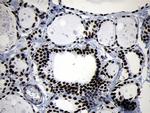 SMC1A Antibody in Immunohistochemistry (Paraffin) (IHC (P))