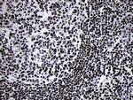 SMC1A Antibody in Immunohistochemistry (Paraffin) (IHC (P))