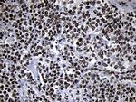 SMC1A Antibody in Immunohistochemistry (Paraffin) (IHC (P))