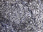 SMC1A Antibody in Immunohistochemistry (Paraffin) (IHC (P))
