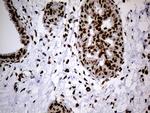 SMC1A Antibody in Immunohistochemistry (Paraffin) (IHC (P))