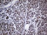 SMC1A Antibody in Immunohistochemistry (Paraffin) (IHC (P))