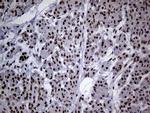 SMC1A Antibody in Immunohistochemistry (Paraffin) (IHC (P))
