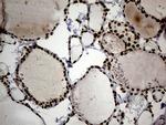 SMC1A Antibody in Immunohistochemistry (Paraffin) (IHC (P))
