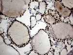 SMC1A Antibody in Immunohistochemistry (Paraffin) (IHC (P))