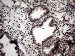 SMC1A Antibody in Immunohistochemistry (Paraffin) (IHC (P))