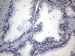 SMC1A Antibody in Immunohistochemistry (Paraffin) (IHC (P))