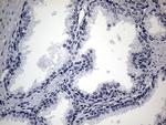 SMC1A Antibody in Immunohistochemistry (Paraffin) (IHC (P))