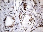 SMC1A Antibody in Immunohistochemistry (Paraffin) (IHC (P))