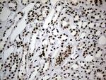 SMC1A Antibody in Immunohistochemistry (Paraffin) (IHC (P))