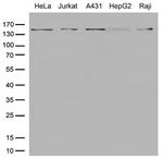 SMC1A Antibody in Western Blot (WB)