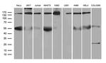 SMC1A Antibody in Western Blot (WB)