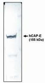 SMC2 Monoclonal Antibody (E1M)