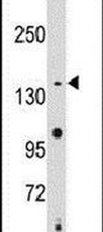 SMC2 Antibody in Western Blot (WB)