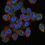 SMN1 Monoclonal Antibody (5H1)