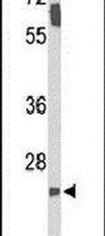 SMNDC1 Antibody in Western Blot (WB)