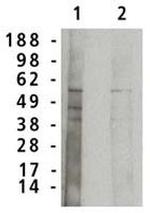 ASM Polyclonal Antibody