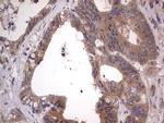 SMPD1 Antibody in Immunohistochemistry (Paraffin) (IHC (P))