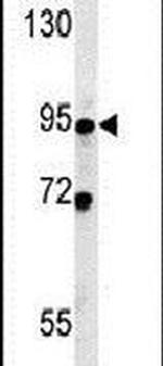 SMPD4 Antibody in Western Blot (WB)