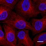 Mouse IgG2b VHH Secondary Antibody in Immunocytochemistry (ICC/IF)