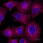 Mouse IgG2b VHH Secondary Antibody in Immunocytochemistry (ICC/IF)