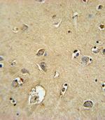 SMS Antibody in Immunohistochemistry (IHC)