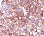 SMURF1 Antibody in Immunohistochemistry (IHC)