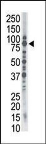 SMURF1 Antibody in Western Blot (WB)