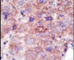 SMURF2 Antibody in Immunohistochemistry (IHC)