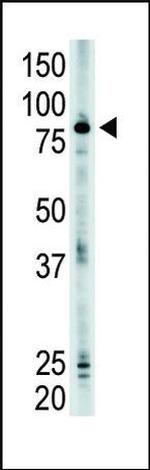SMURF2 Antibody in Western Blot (WB)