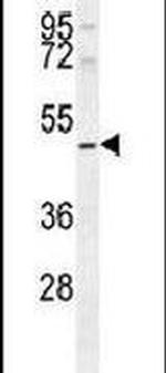 SMYD1 Antibody in Western Blot (WB)