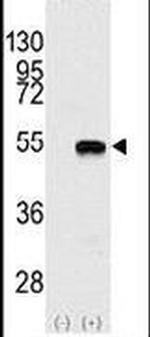 SMYD2 Antibody in Western Blot (WB)