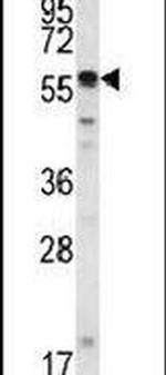 SMYD2 Antibody in Western Blot (WB)