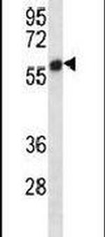 SMYD2 Antibody in Western Blot (WB)