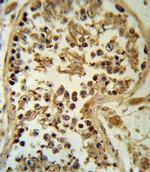 SMYD3 Antibody in Immunohistochemistry (IHC)