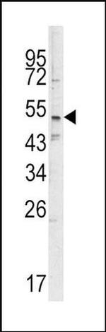SMYD3 Antibody in Western Blot (WB)