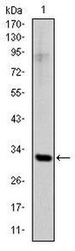 SNAIL Monoclonal Antibody (6D2)