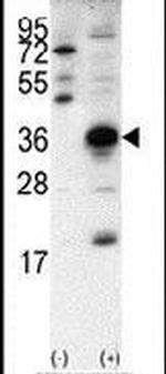 SNAIL Antibody in Western Blot (WB)