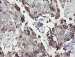 SNAI2 Antibody in Immunohistochemistry (Paraffin) (IHC (P))