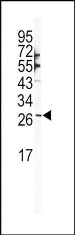 SNAIL Antibody in Western Blot (WB)