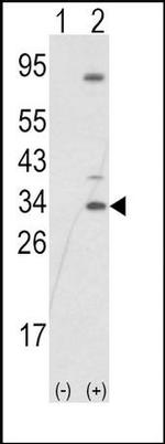 SNAIL Antibody in Western Blot (WB)