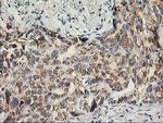SNAP25 Antibody in Immunohistochemistry (Paraffin) (IHC (P))