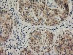 SNAP25 Antibody in Immunohistochemistry (Paraffin) (IHC (P))