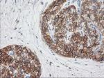 SNAP25 Antibody in Immunohistochemistry (Paraffin) (IHC (P))