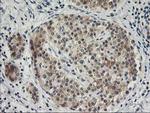 SNAP25 Antibody in Immunohistochemistry (Paraffin) (IHC (P))