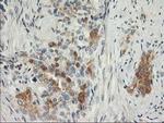 SNAP25 Antibody in Immunohistochemistry (Paraffin) (IHC (P))
